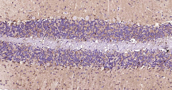 NSE Recombinant Rabbit Monoclonal Antibody