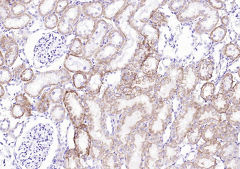 JAK1 Recombinant Rabbit Monoclonal Antibody