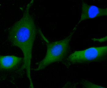CLOCK Recombinant Rabbit Monoclonal Antibody