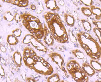CLOCK Recombinant Rabbit Monoclonal Antibody