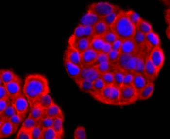 CD90/Thy-1 Recombinant Rabbit Monoclonal Antibody