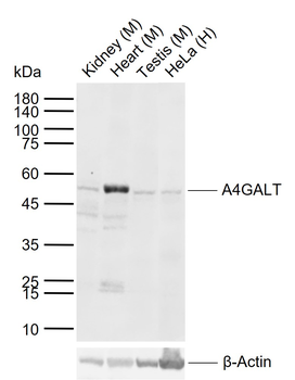 A4GALT Rabbit Polyclonal Antibody