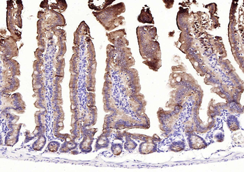 Villin Mouse Monoclonal Antibody