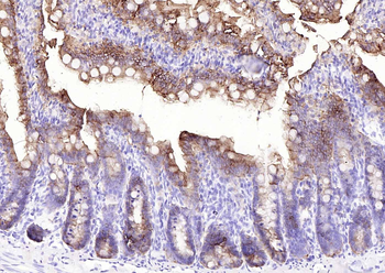 Villin Mouse Monoclonal Antibody