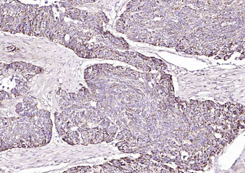 TRPM8 Rabbit Polyclonal Antibody