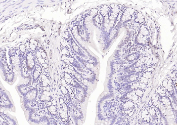 HNF1A Rabbit Polyclonal Antibody