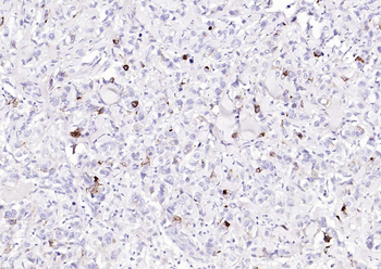 Mucin-1 Mouse Monoclonal Antibody
