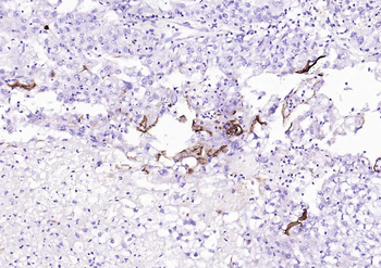 Mucin-1 Mouse Monoclonal Antibody