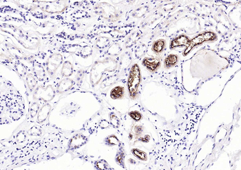 Mucin-1 Mouse Monoclonal Antibody