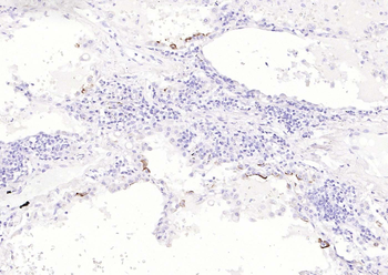 Mucin-1 Mouse Monoclonal Antibody