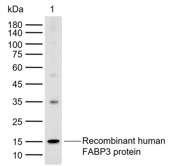 FABP3/H-FABP Rabbit Polyclonal Antibody