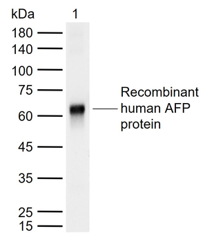 AFP Mouse Monoclonal Antibody
