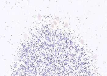 Phospho-Munc18-1 (Thr574) Rabbit Polyclonal Antibody