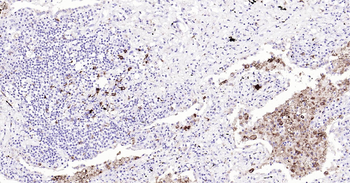 Human CD68 Ready-To-Use IHC Kit