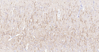 Rat NF-L Ready-To-Use IHC Kit