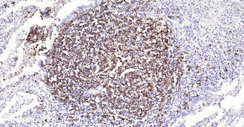 Human CD20 Ready-To-Use IHC Kit