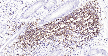 CD20 Ready-To-Use IHC Kit