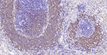 CD20 Ready-To-Use IHC Kit