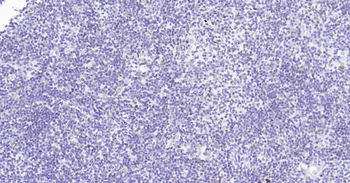 Rat PCNA Ready-To-Use IHC Kit
