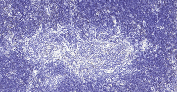 Mouse PCNA Ready-To-Use IHC Kit