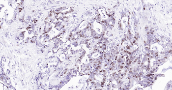 Human PCNA Ready-To-Use IHC Kit