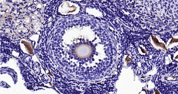 AMH Mouse Monoclonal Antibody
