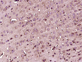 Fbxw7 Rabbit Polyclonal Antibody