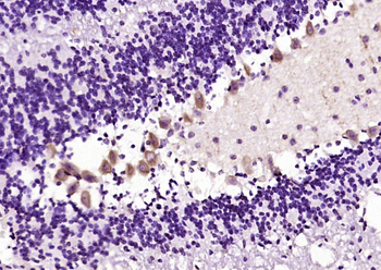 Alpha neoendorphin Rabbit Polyclonal Antibody