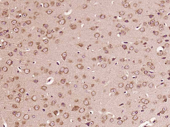 B4GALNT1/GM2 synthase Rabbit Polyclonal Antibody