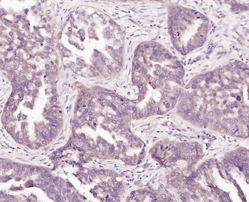 Beta neoendorphin Rabbit Polyclonal Antibody