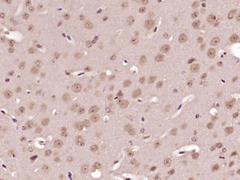 Beta neoendorphin Rabbit Polyclonal Antibody