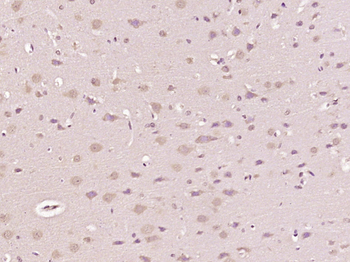Beta neoendorphin Rabbit Polyclonal Antibody