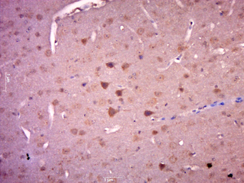CCK39 Rabbit Polyclonal Antibody