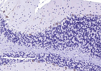CALB1 Rabbit Polyclonal Antibody