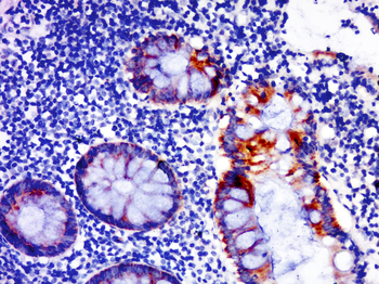CORO7 Rabbit Polyclonal Antibody