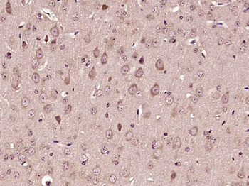 COX6A1 Rabbit Polyclonal Antibody