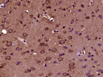 CRB2 Rabbit Polyclonal Antibody