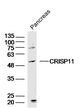 CRISP11 Rabbit Polyclonal Antibody