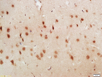 CROP Rabbit Polyclonal Antibody