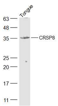 CRSP8 Rabbit Polyclonal Antibody