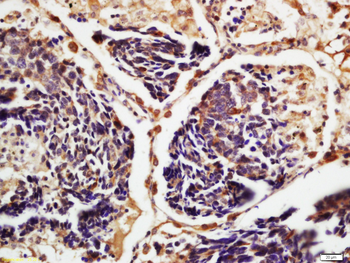 CSDE1 Rabbit Polyclonal Antibody