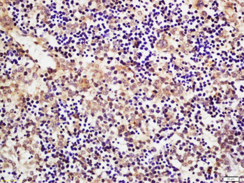 CSDE1 Rabbit Polyclonal Antibody