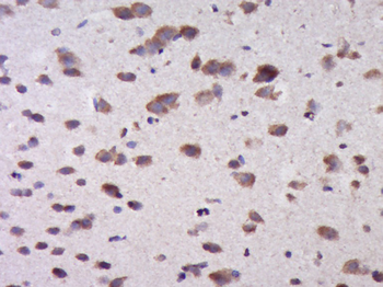 CTTNBP2NL Rabbit Polyclonal Antibody