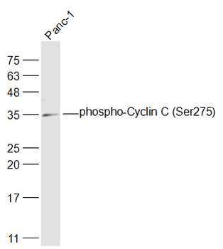 Phospho-Cyclin C (Ser275) Rabbit Polyclonal Antibody
