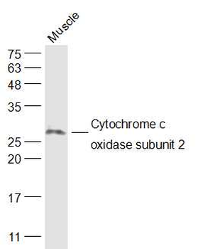 MTCO2 Rabbit Polyclonal Antibody