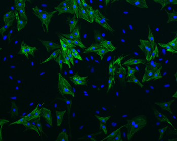 Cardiac Troponin T Rabbit Polyclonal Antibody