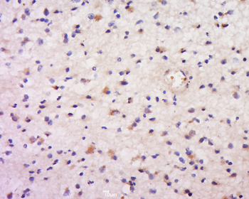 DAND5/GREM3 Rabbit Polyclonal Antibody