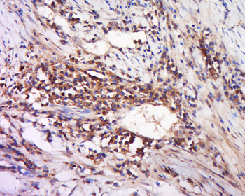 DAND5/GREM3 Rabbit Polyclonal Antibody