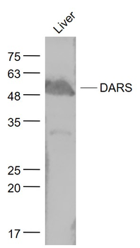 DARS Rabbit Polyclonal Antibody