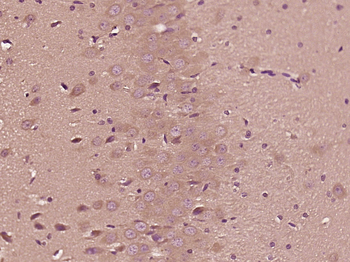 DENND1A Rabbit Polyclonal Antibody